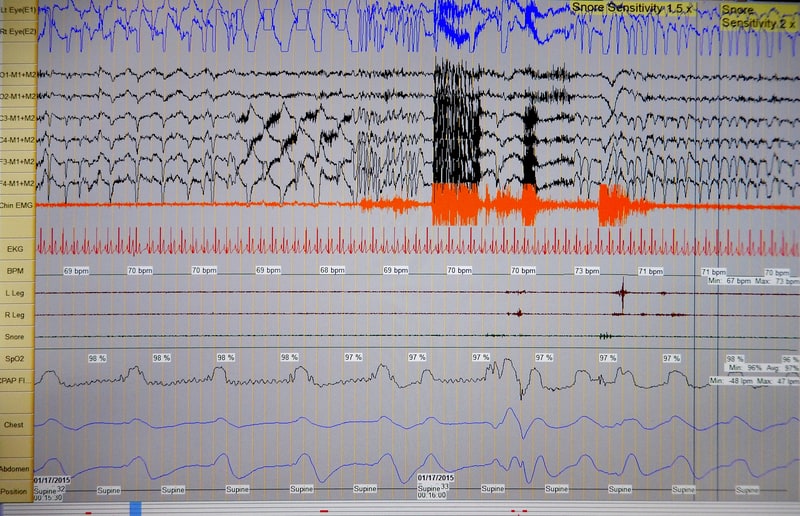 Sleep Study Wave form